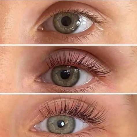 Check out these stunning before and after results with our lash growth serum. Longer, fuller lashes in just weeks! 💥 #LashGoals #BeforeAndAfter #LashSerum #BeautyTransformations Shop Now - https://www.dermaworks.co.uk/products/spectaculash-eyelash-growth-serum