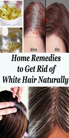 How To Use Coconut Oil And Lemon Juice For Gray Hair Get Rid Of White Hair, Grey Hair Home Remedies, Remove Gray Hair, Reverse Gray Hair, Hair Growing Tips, Home Remedies For Hair, Damaged Hair Repair, Hair Repair, Natural Hair Color