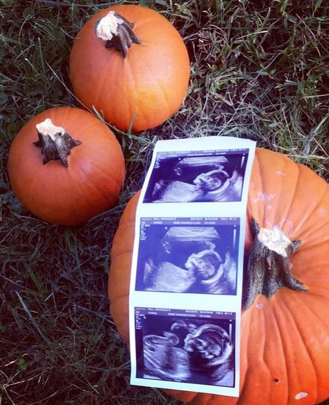 Pumpkin Patch Maternity Pictures, Fall Maternity Shoot, Lil Pumpkin Baby Shower, Bump Pictures, Baby Bats, Fall Maternity, Baby Shower Pumpkin, Baby In Pumpkin, A Lot Of People