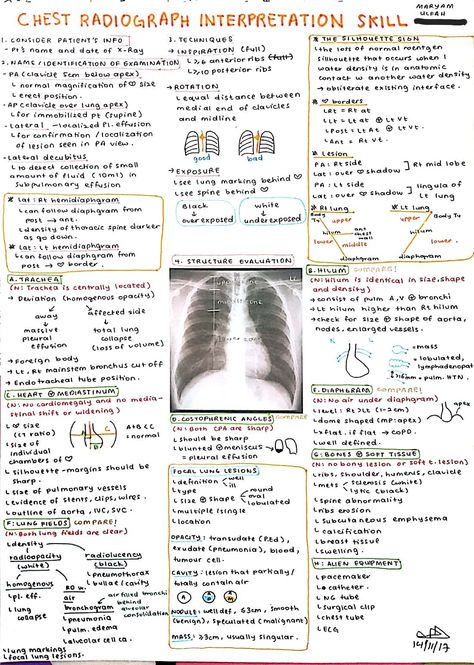 Chest X Ray Radiology, X Ray Technique Chart, Chest X Ray Interpretation, X Ray Positioning Chart, Radiology Notes Aesthetic, Chest Xray Interpretation, X Ray School, X-ray Tech, Radiology Technician Aesthetic