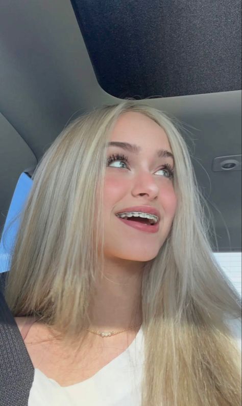 Blonde With Braces, Pretty Girls With Braces Blonde Hair, Blonde Green Eyes, Brunette Roots, Pretty Blonde Hair, Blonde Hair Green Eyes, Blonde With Blue Eyes, Pretty Blonde, Billy Boy