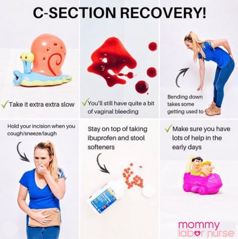 C Section Recovery: What Happens Right After Your C Section Postpartum Symptoms, Scheduled C Section, Hospital Bag List, Postpartum Care Kit, Pregnancy Facts, C Section Recovery, Cesarean Section, Baby Delivery, Labor Nurse