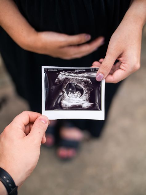 Pregnancy Accountment Photoshoot, Usg Pregnancy Photography, Simple Baby Announcement Picture Ideas, Simple Pregnancy Announcement Photos, Simple Pregnancy Photos, Pregnancy Announcement Photos First, Pregnancy Announcement Flat Lay, Studio Pregnancy Announcement, Baby On The Way Announcement