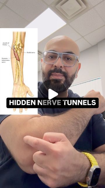 Trapped Nerve, Hidden Tunnel, Radial Nerve, The Nerve, Lower Limb, Carpal Tunnel, Nerve, Anatomy, Things To Come