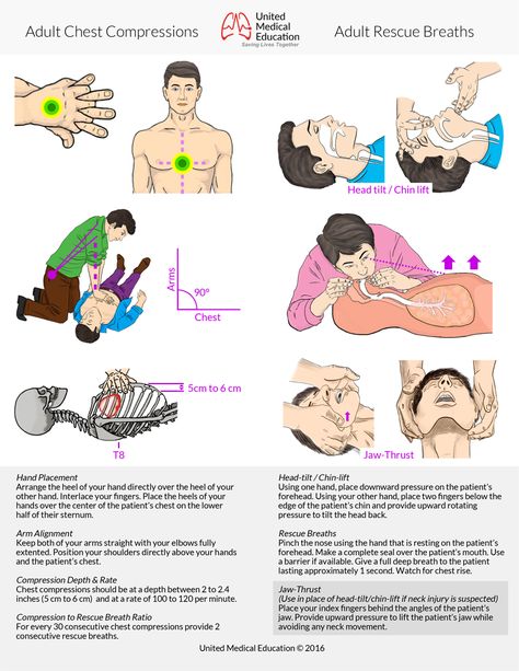 BLS algorithms for 2020. Free instructional guide for Basic Life Support with illustrated training. Basic Life Support Training, Acls Study Guide, Acls Algorithm, Nursing Information, Basic Life Support, Medical School Studying, Medical School Essentials, Life Support, Emergency Medicine