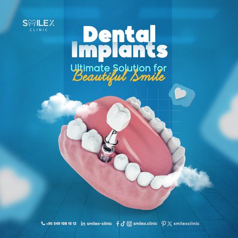 😊Say goodbye to gaps and hello to a beautiful smile with dental implants .  💪the ultimate solution for restoring your confidence!  💪 At SmileX, our experienced team ensures seamless integration and natural-looking results.  📞Reclaim your smile and schedule your implant consultation today!  ⚪ISTANBUL TÜRKÌYE  #orthodontics #straightteeth #veneers⁠ #tooth #dentalimplants #teethwhitening ⁠ #dentist #dental #dentistry #teeth⁠ #İstanbul #türkiye ⁠ Dental Implants Creative Ads, Dental Post, Burger Ads, Dental Ads, Cosmetic Web, Dental Advertising, Dental Posts, Dental Logo Design, Teeth Design