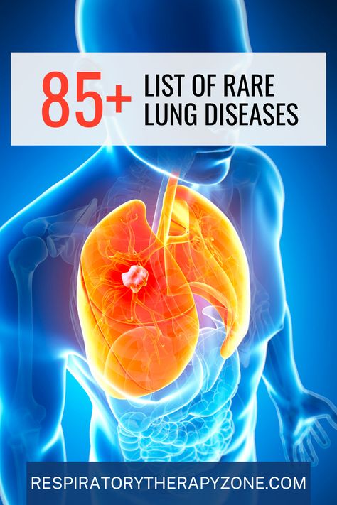 Dive into the ultimate guide of 85+ rare lung diseases, from Pulmonary Fibrosis to Lymphangioleiomyomatosis. This comprehensive list offers insights into symptoms, causes, and treatments. Essential reading for patients, caregivers, and healthcare professionals. Pin this for awareness and support! Bronchopulmonary Dysplasia, Lung Support, Chronic Lung Disease, Failure To Thrive, Rare Genetic Disorders, Lung Conditions, Lung Infection, Rare Disorders, Lung Transplant