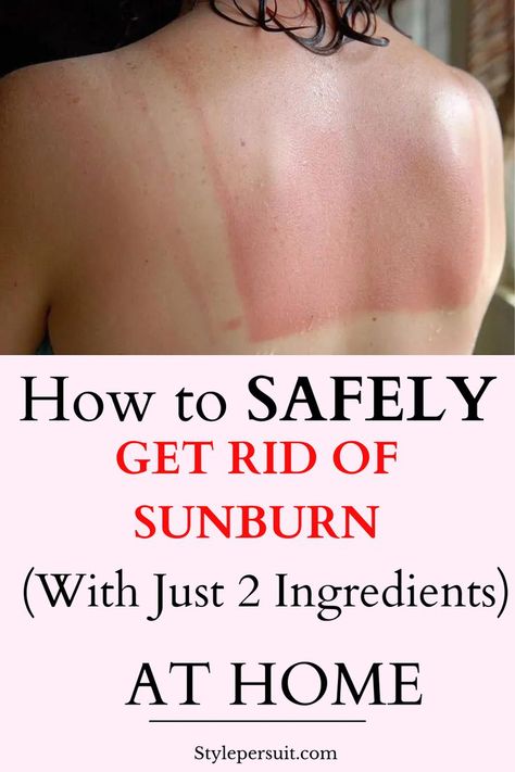 Sunburn, the painful result of overexposure to ultraviolet (UV) rays from the sun, is an all-too-common summertime ailment. Whether you forgot to apply sunscreen or simply spent too much time outdoors, dealing with sunburn can be uncomfortable and frustrating. While there are numerous over-the-counter remedies available, many people prefer natural alternatives to soothe their sun-damaged skin. Check out these effective methods for getting rid of sunburn naturally. ##skincare Skin Peeling From Sunburn, Sun Blisters, Sunburn On Face, Best Sunburn Relief, Sunburn Blisters, Get Rid Of Sunburn, Sunburn Peeling, Natural Remedies For Sunburn, Sunburn Remedies