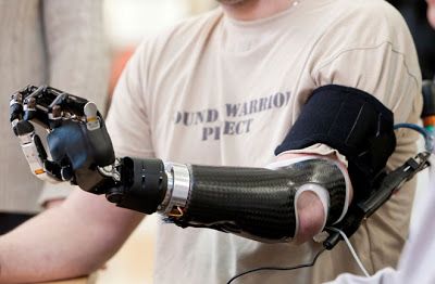 prosthetic limbs image | With a Modular Prosthetic Limb, nerves that previously went to a ... Robotic Prosthetics, Interior Design Gifts, Mechanical Arm, Sense Of Touch, Stylish Interior Design, The Future Is Now, Johns Hopkins University, Johns Hopkins, Latest Design Trends