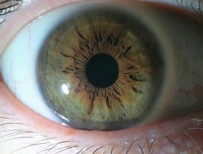 How to Tell What Your True Eye Color Is! Eye Season Iridology, Different Types Of Green Eyes, Central Heterochromia Eyes, Eye Color Chart Genetics, Green Eyes Facts, Blue Hazel Eyes, Eye Color Facts, Grey Green Eyes, Rare Eye Colors