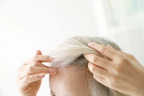 mature-woman-touching-hairline-getty-0521 Scalp Scabs, Hair Wellness, Treat Thinning Hair, Dunner Wordend Haar, Androgenetic Alopecia, Thickening Shampoo, Boost Hair Growth, Hair Shedding, Lost Hair