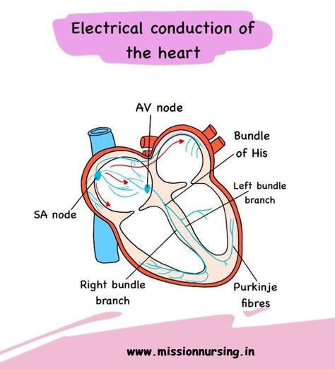 Electrical Conduction of heart Electrical Conduction Of Heart, Conduction Of The Heart, Conduction System Of The Heart, Medical Laboratory Science Student, Notes Nursing, Heart Diagram, Nurse Study, Nursing Information, Staff Nurse