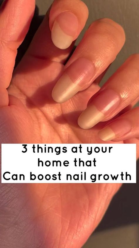 Ways to grow your nails super fast Hair Color Fall, Grow Long Nails, Nail Growth Tips, Grow Nails Faster, Natural Nail Care, Nagel Tips, Pink Gel, Nail Care Tips, Nail Care Routine