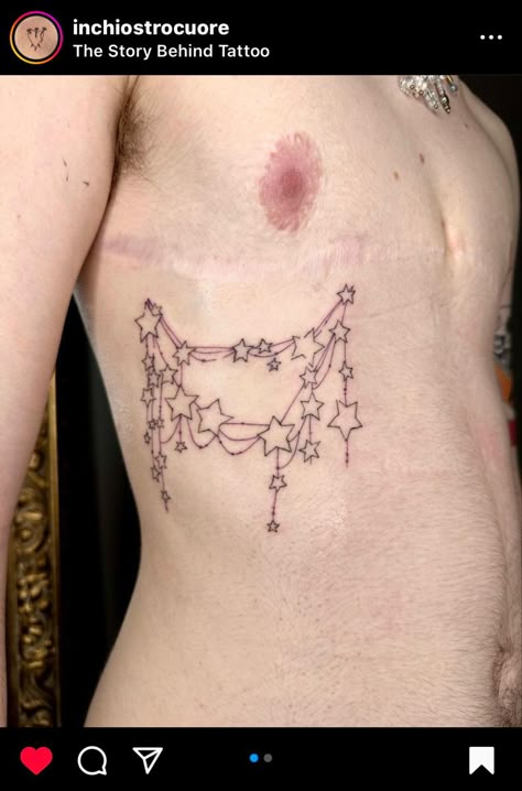 Ftm Surgery Tattoo, Top Surgery Scar Designs, Tattoo Ideas Top Surgery, Trans Masc Chest Tattoos, Trans Top Surgery Art, Chest Surgery Tattoo, Tattoos Top Surgery, Transmasc Tattoo Ideas, Too Surgery Tattoo