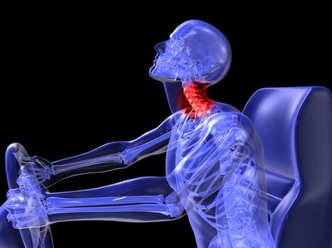 Healing Whiplash Injury | Whiplash Can Cause Chronic Health Problems | Blair Upper Cervical Chiropractic Whiplash Injury, Neck Injury, Accident Injury, Chiropractic Care, Whiplash, Muscle Pain, Chiropractic, Law Firm, Headache