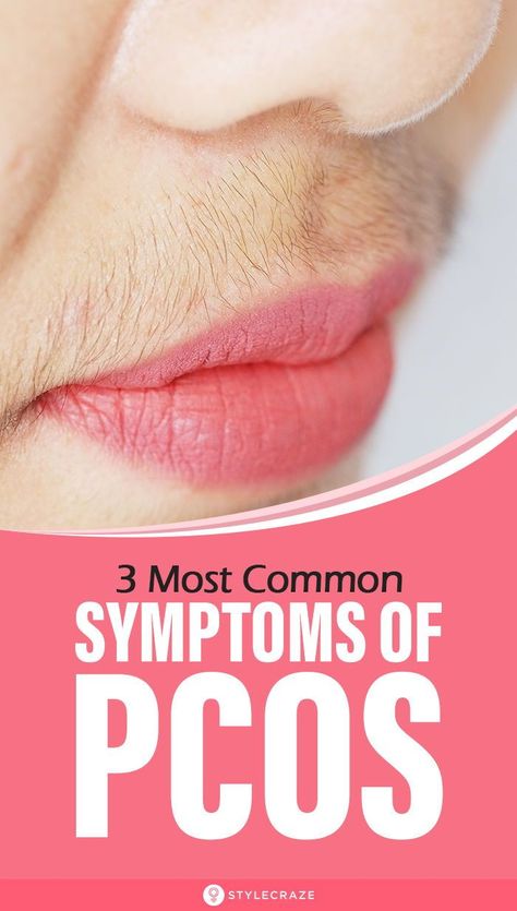 Upper Lip Hair, Low Estrogen Symptoms, Too Much Estrogen, Low Estrogen, Women Health Care, Lip Hair, Unwanted Hair Removal, Upper Lip, Good Health Tips