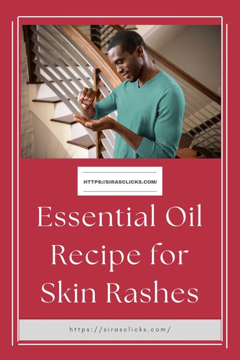 Essential Oils For Rash, Lavender Oil Recipes, Tea Tree Oil Uses, Abdominal Pain Relief, Esential Oils, Skin Tea, Skin Rashes, Healing Essential Oils, Making Essential Oils