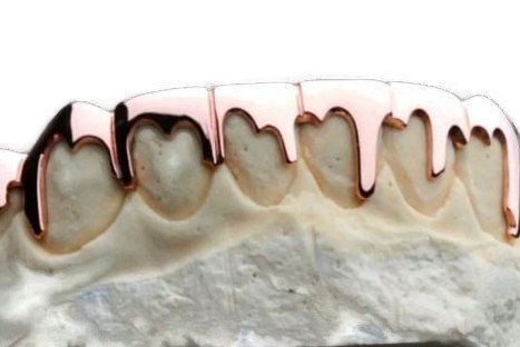 Rose Gold Grillz, Dripping Effect, Clary Y Jace, Dental Jewelry, Pink Gold Jewelry, Custom Grillz, Teeth Whitening Remedies, Gold Drip, Teeth Bleaching