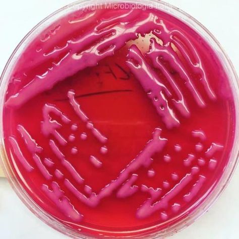 Klebsiella spp. su Macconkey agar Macconkey Agar, Klebsiella Pneumoniae, Medical Lab Technician, Medical Laboratory Technician, Microbiology Lab, Clinical Chemistry, Lab Work, Laboratory Technician, Medical Lab