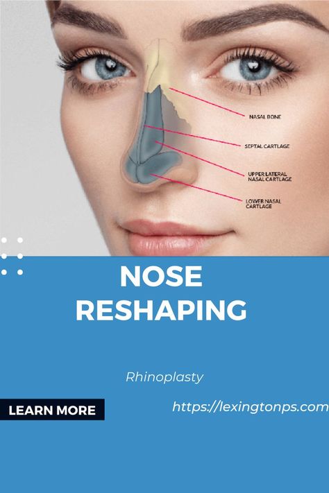 Nose Reshaping, Rhinoplasty Surgery, Face Surgery, Plastic Surgery Procedures, Surgery Center, Celebrity Plastic Surgery, Lexington Ky, Plastic Surgery, Surgery