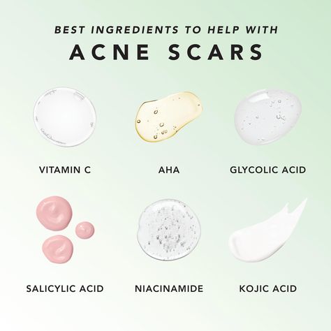 Dark Spot And Acne Scar Remover, Acne Scarring Products, Clear Acne And Scars, Acne Safe Skincare, Acne Safe Makeup Products, Acne Pit Scars, Best Acne Scar Removal, Acne Safe Makeup, Fade Acne Marks