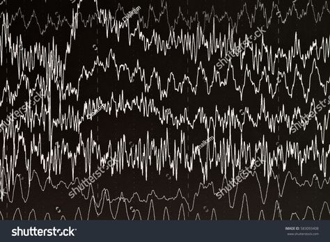 Brain Waves Aesthetic, Illustration Art Kids, Brain Waves, Human Brain, Art Kids, Wave Design, Biology, Black Background, Black Backgrounds