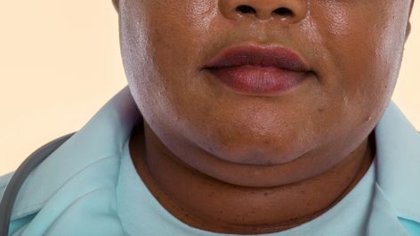 Neck Fat Exercises, Basic Poses, Tighten Neck Skin, Swollen Face, Double Chin Exercises, Chin Exercises, Healthy Eating Guidelines, Start A Diet, Mind Heart