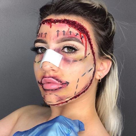 Botched Surgery Costume, Plastic Surgery Makeup Halloween, Botched Plastic Surgeries Costume, Botched Halloween Costume, Plastic Surgery Halloween Makeup, Botched Plastic Surgeries, Plastic Surgery Costume, Plastic Surgery Halloween, Plastic Surgery Makeup