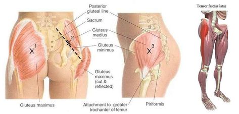 Hip Abductor: Muscles, Stretching & Strengthening Exercises Hip Abductor Exercises, Psoas Release, Bursitis Hip, Hip Problems, Gluteal Muscles, Gluteus Medius, Tight Hip Flexors, Human Body Anatomy, Psoas Muscle