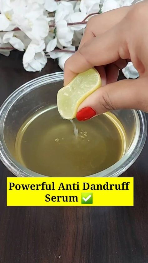 Shalini ♥️ Skin & Hair care 💁‍♀️ | 🥰🥰 Powerful Serum for get rid of dandruff Hair fall & get Long Thick, double density , Fast hair growth ✨ Ingridents ✅ Neem leaves +… | Instagram How To Get Rid Of Dandruff Fast At Home, How To Get Rid Of Dandruff, Neem Leaves, Rid Of Dandruff, Lemon Juice Uses, Dandruff Hair, Fast Hair Growth, Getting Rid Of Dandruff, Fast Hair