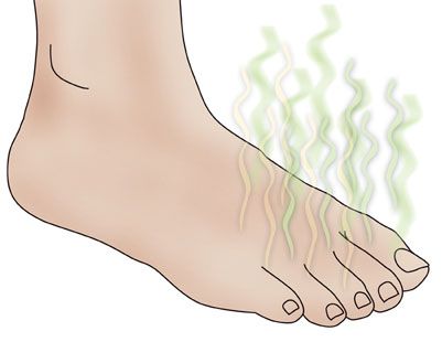 smelly feet Life Cheats, Antifungal Cream, Athletes Foot, Clear Skin Tips, Healthy Skin Tips, Body Hacks, Skin Remedies, Natural Home Remedies, Skin Tips