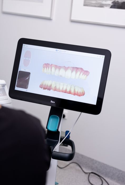 Itero Scanner, Dental Studio, Dental Impressions, 3d Scanners, 3d Scanner, 3d Scanning, Art 3d, Assessment, To Create