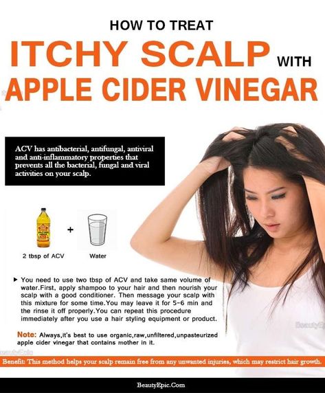 How to Treat Dry Itchy Scalp Using Apple Cider Vinegar (ACV) Apple Cider Vinegar Remedies, Vinegar For Hair, Apple Cider Vinegar For Hair, Hair Conditioning, Dandruff Remedy, Dry Itchy Scalp, Hair Dandruff, Itchy Scalp, Grow Hair Faster