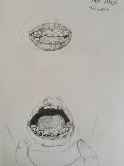 When I first got braces. Draw a man made pattern = braces, summer 2013 brief also Braces Mouth Drawing, Mouth With Braces Drawing, Teeth With Braces Drawing, How To Draw A Smile With Teeth, How To Draw Braces, Braces Drawing Reference, Drawing Braces, Lips With Braces, Mouth With Braces