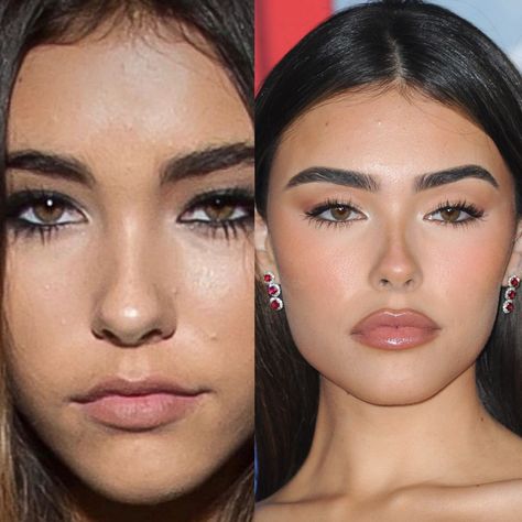 Madison Beer plastic surgery Eyebrow Lift Surgery, Madison Beer Plastic Surgery, Filler Face, Botox Lip Flip, Lip Job, Face Plastic Surgery, Foxy Eye, Lip Flip, Botox Brow Lift