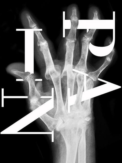 pain — bergerstadelwalsh.com X Ray Graphic Design, Switzerland Basel, Corporate Id, Protest Posters, Typo Design, Spatial Design, Content Design, Typographic Poster, International Design