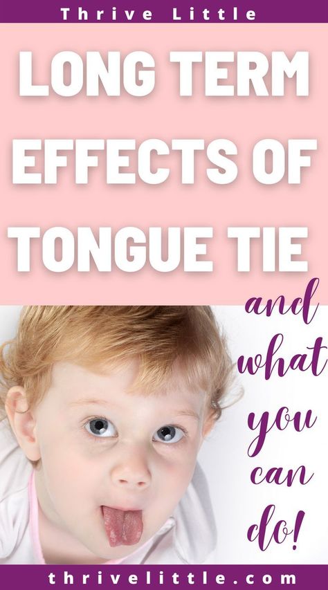 What health insurance options are available when y Tonsils And Adenoids, Feeding Therapy, Tongue Scraper, Picky Eating, Health Signs, Tongue Health, Tongue Tie, Toddler Development, Life Group