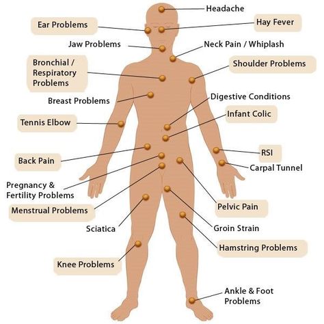 Bowen Therapy Techniques, Bowen Technique, Bowen Therapy, Acupressure Therapy, Fertility Problems, Muscle Anatomy, Shiatsu Massage, Alternative Healing, Pelvic Pain