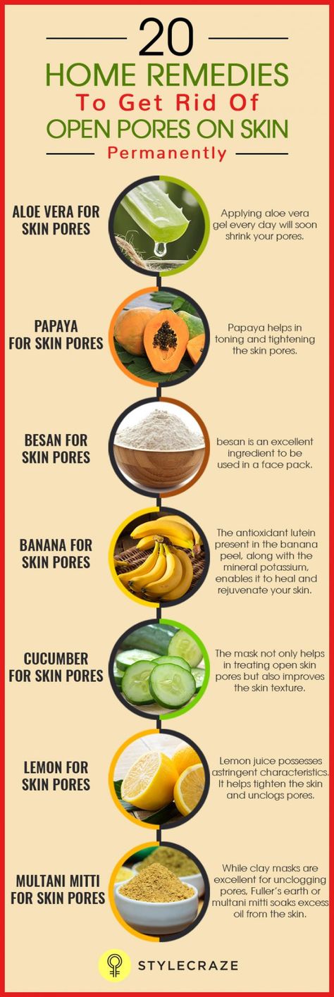 20-Home-Remedies-To-Get-Rid-Of-Open-Pores-On-Skin-Permanently.., Pores On Face, Aloe Vera For Skin, Home Remedies For Skin, Open Pores, Organic Remedy, Baking Soda Shampoo, Makeup Tricks, Skin Pores, Skin Remedies