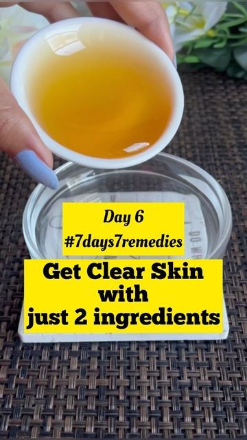 Anitha Sam on Instagram: "Get clear skin with just 2 ingredients ❤️ Follow @ani_beautydiy for more videos 📌 Save this and try for later . . . Honey and turmeric helps to reduce the appearance of wrinkles, as well as brighten the skin by lightening dark spots and improving overall skin tone Follow this every alternative dats for good results #skincare #glowingskin #clearskin #skincaretips #reels #reelsinstagram #trendingreels #skincareroutine DISCLAIMER: This video is for informational purpo Tumeric Skin Lightening, Turmeric Benefits For Skin, Honey And Turmeric, Tumeric And Honey, Lightening Dark Spots, Skin Lightening Diy, Get Clear Skin, Honey Skin, Homemade Items