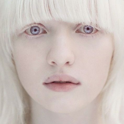 Axis Layla Fey - A natural albino, has difficulty seeing in bright light and is easily sunburned.  She is lovely, such a beautiful face. Albino Model, Albino Girl, Violet Eyes, Pastel Decor, Purple Eyes, Pale Skin, People Of The World, Interesting Faces, 인물 사진