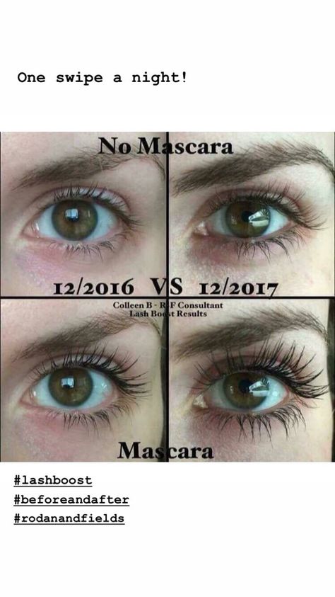 Lash boost Lash Serum Results, Subliminals Aesthetic, Beautiful Skin Care, Lash Boost, Life Hacks Beauty, Hair Growing Tips, Beauty Tips For Glowing Skin, Lash Serum, Hair Scarf Styles