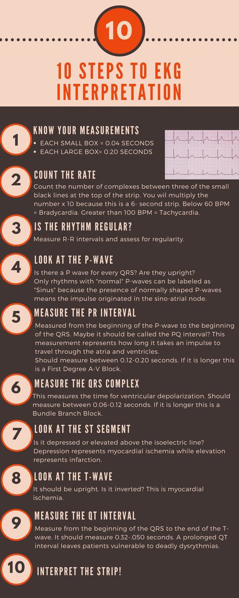 Ekg Interpretation Made Easy, Ekg Interpretation, Paramedic School, Nursing Cheat, Cardiac Nursing, Nursing School Survival, Critical Care Nursing, Nursing School Studying, Nursing School Tips