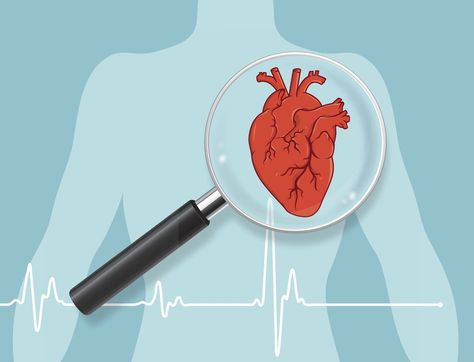 Cardiac Diet, Clogged Arteries, Congenital Heart, Human Heart, Chest Pain, Art Simple, Cardiovascular Disease, Heart Health, Heart Healthy