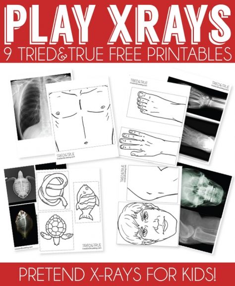 9 Play X-Rays Free Printables from Tried & True. Print out on transparent paper and enjoy! Medical Play, Pretend Play Printables, Community Helpers Theme, People Who Help Us, Dramatic Play Preschool, Dramatic Play Area, Playing Doctor, Dramatic Play Centers, X Rays