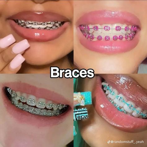 Aesthetic Braces Color, Hot Pink Braces, Perfect Teeth Braces, Purple Braces, Power Chain Braces, Braces Colors Combinations, Pink Braces, Braces Colors Ideas, Red Braces