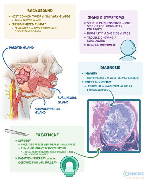 Pleomorphic adenomas are the most common tumors of the salivary glands Salivary Glands, Oral Pathology, Salivary Gland, Family Nurse Practitioner, Study Essentials, Medical Student Study, Medical Studies, Human Anatomy And Physiology, Medical School Essentials