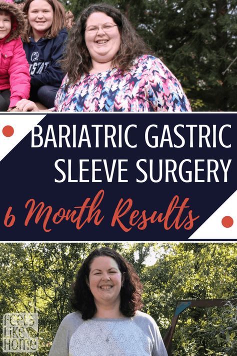 Sleeve Surgery Diet, Isagenix Cleanse, Stomach Sleeve, Bariatric Sleeve, Bariatric Diet, Sleeve Gastrectomy, Sleeve Surgery, Bariatric Eating, Bypass Surgery