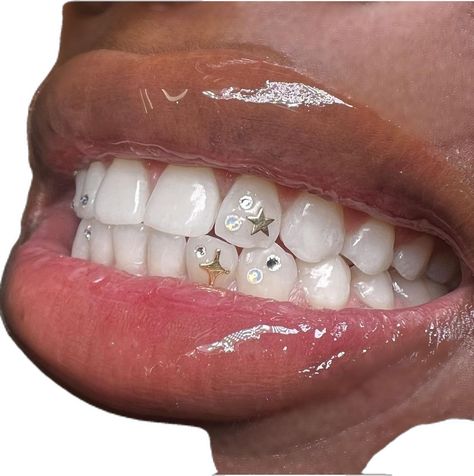 Tooth Gems On Invisalign, Gemzeez Tooth, Single Tooth Gem, Gold Tooth Gem, Tooth Gems Bottom Teeth, Teeth Gems Ideas, Star Tooth Gem, Tooth Gem Placement, Teeth Jewels