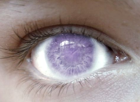 Lilac Eyes Aesthetic, Unnatural Eye Color, Light Purple Eyes, Oddly Aesthetic, Oc Details, Lilac Eyes, Purple Vampire, Lavender Eyes, Amethyst Eyes